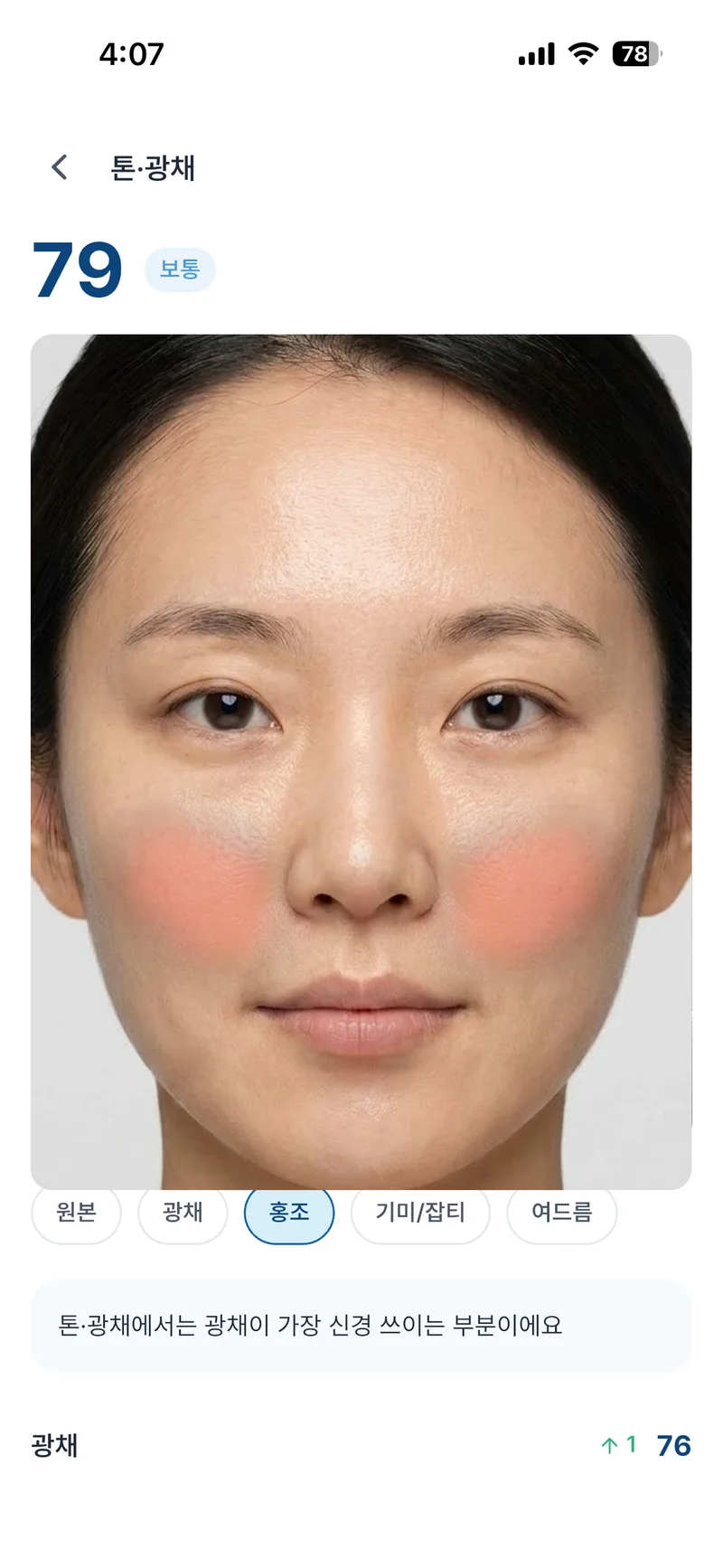 SkiNote 톤·광채 오버레이 화면 — 홍조 부위가 얼굴 위에 표시된 모습